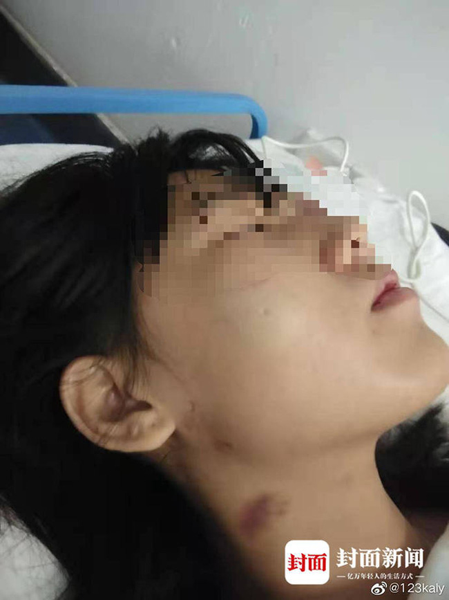 Người phụ nữ ôm gương mặt bê bết máu chạy đến bệnh viện khiến nhiều người hoang mang, tiết lộ bi kịch suýt bị chôn sống suốt 5 năm qua - Ảnh 2.