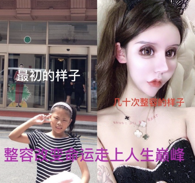 Mẫu nữ Trung Quốc nghiện dao kéo, gương mặt sau 101 lần phẫu thuật thẩm mỹ - Ảnh 2.