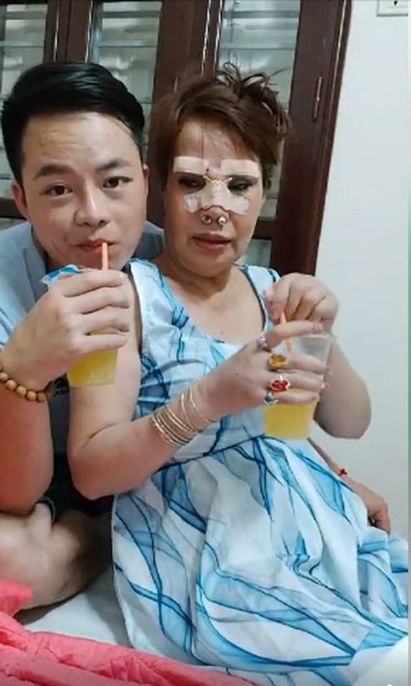 Cô dâu 63 tuổi ở Cao Bằng sau 2 tháng phẫu thuật căng da mặt, diện mạo khiến ai cũng “đồng ý là dao kéo hỏng” - Ảnh 7.