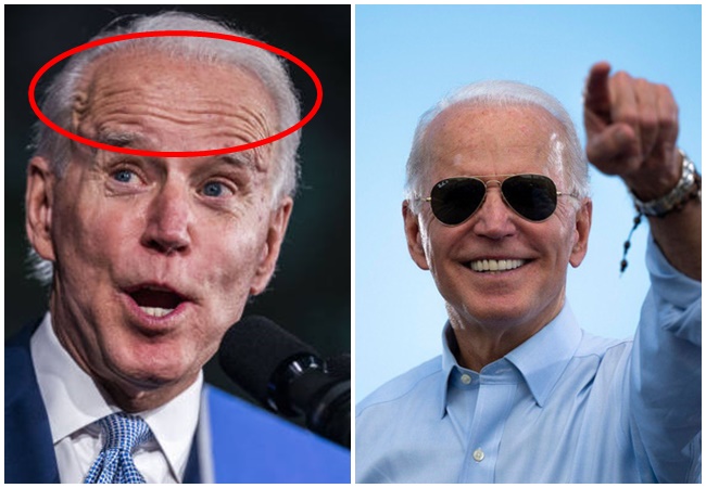 76 tuổi vẫn phong độ lịch lãm, ông Joe Biden để lộ bằng chứng nhiều lần phẫu thuật để &quot;níu kéo tuổi xuân&quot; từ cấy tóc, căng da đến cắt mí - Ảnh 4.
